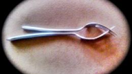 我吃很多食物，饮料比我应该吃的更多，重量正在伤害我的性生活。我什至没有发现自己有吸引力，也害怕与女性建立关系。是康复的时间。